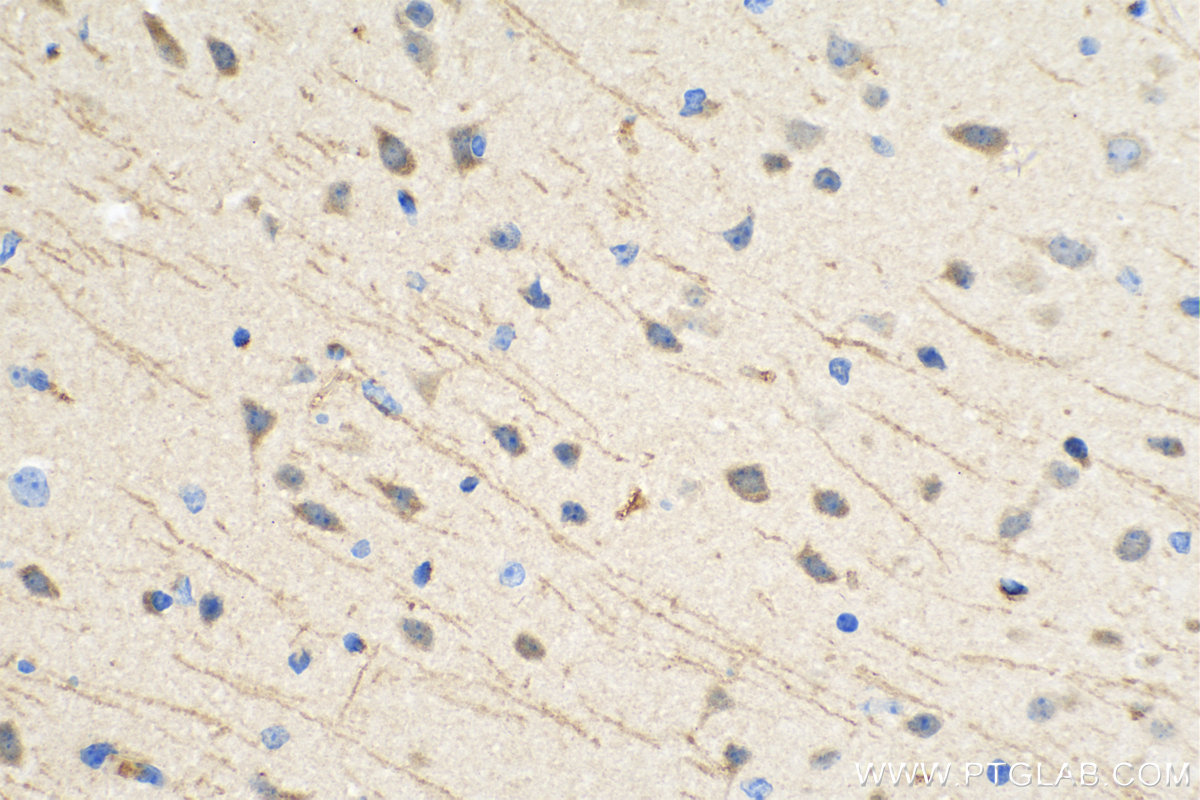 IHC staining of mouse brain using 24084-1-AP