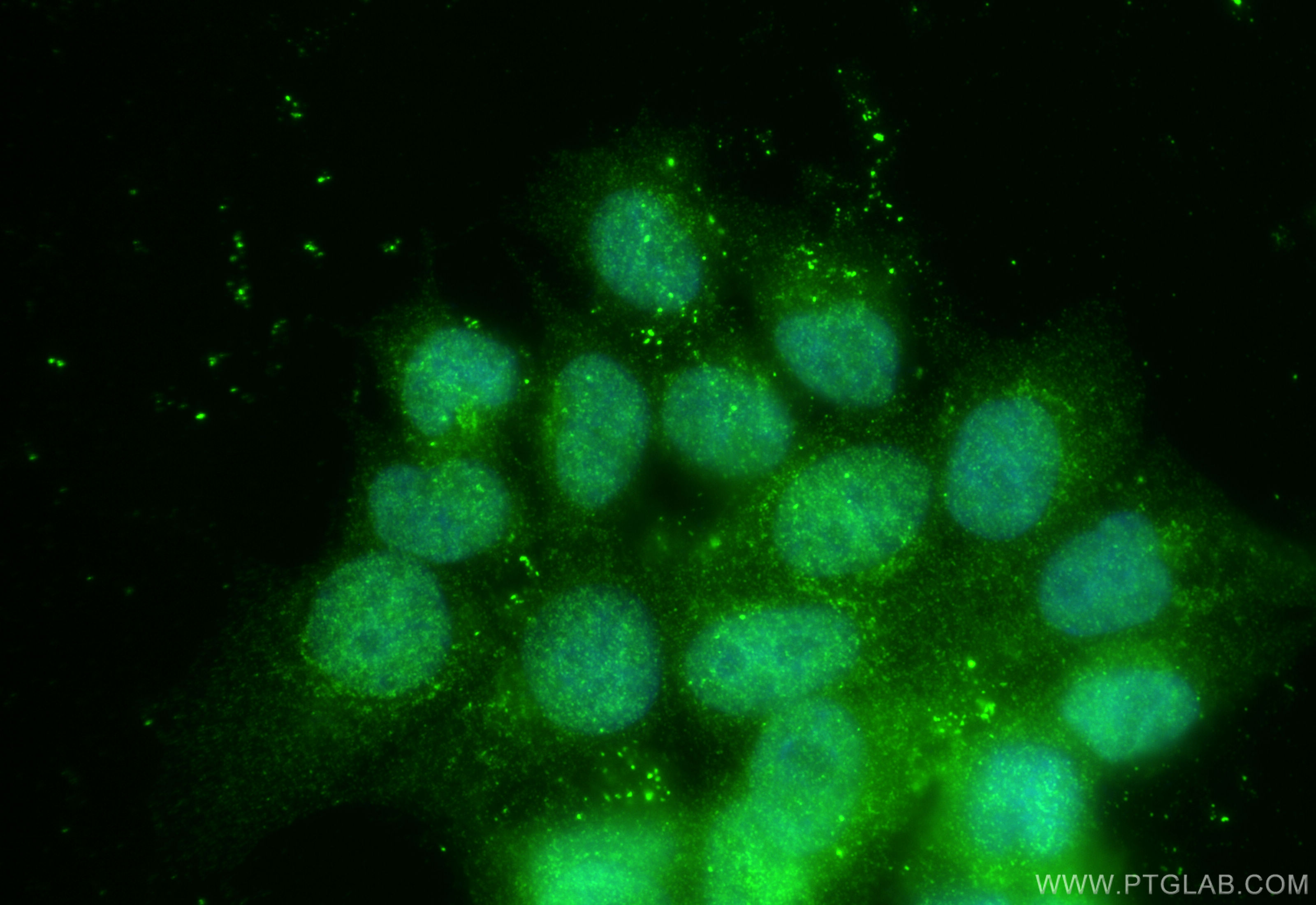 IF Staining of MCF-7 using 11040-1-AP