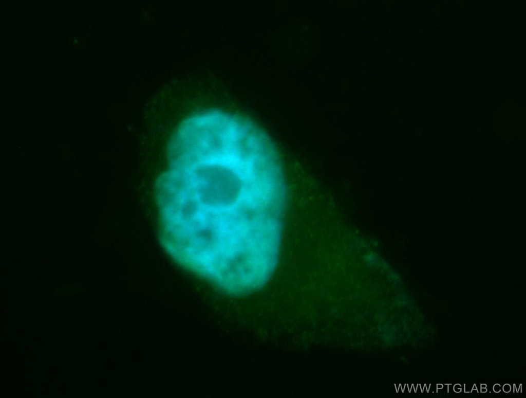 IF Staining of MCF-7 using 11040-1-AP