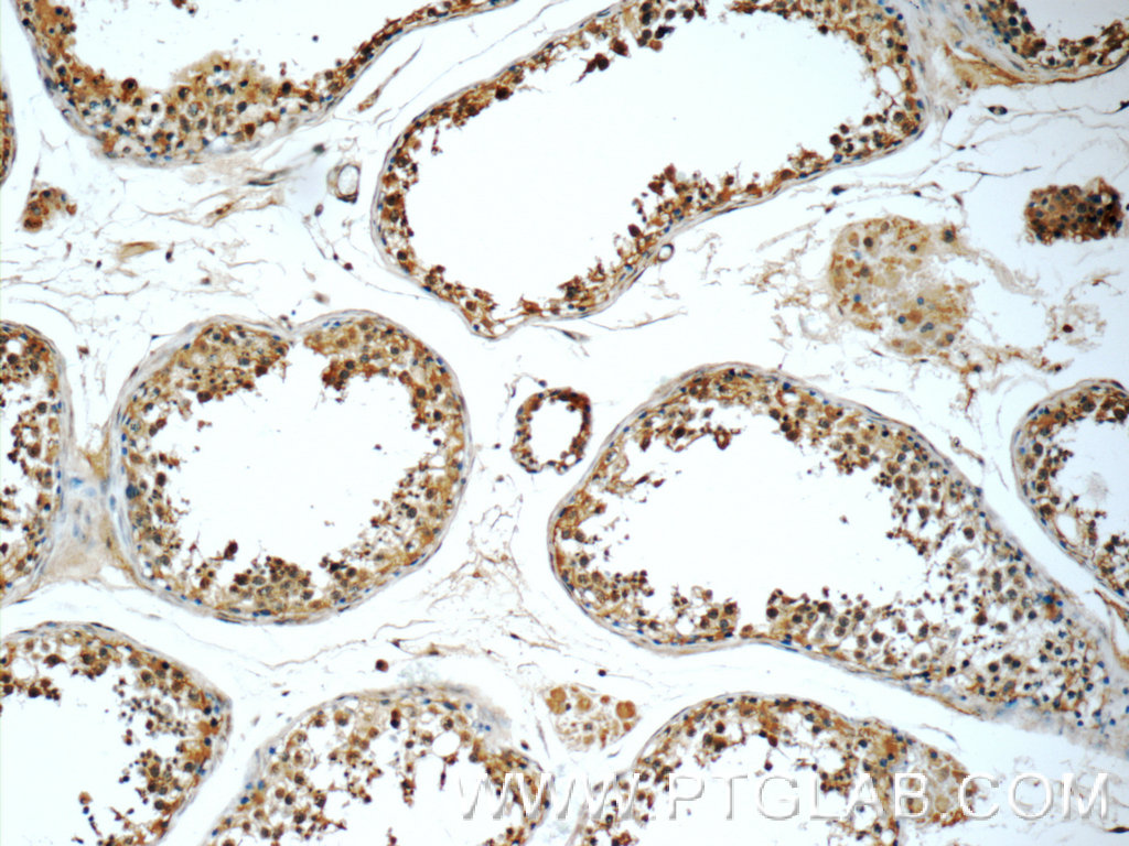 IHC staining of human testis using 17730-1-AP