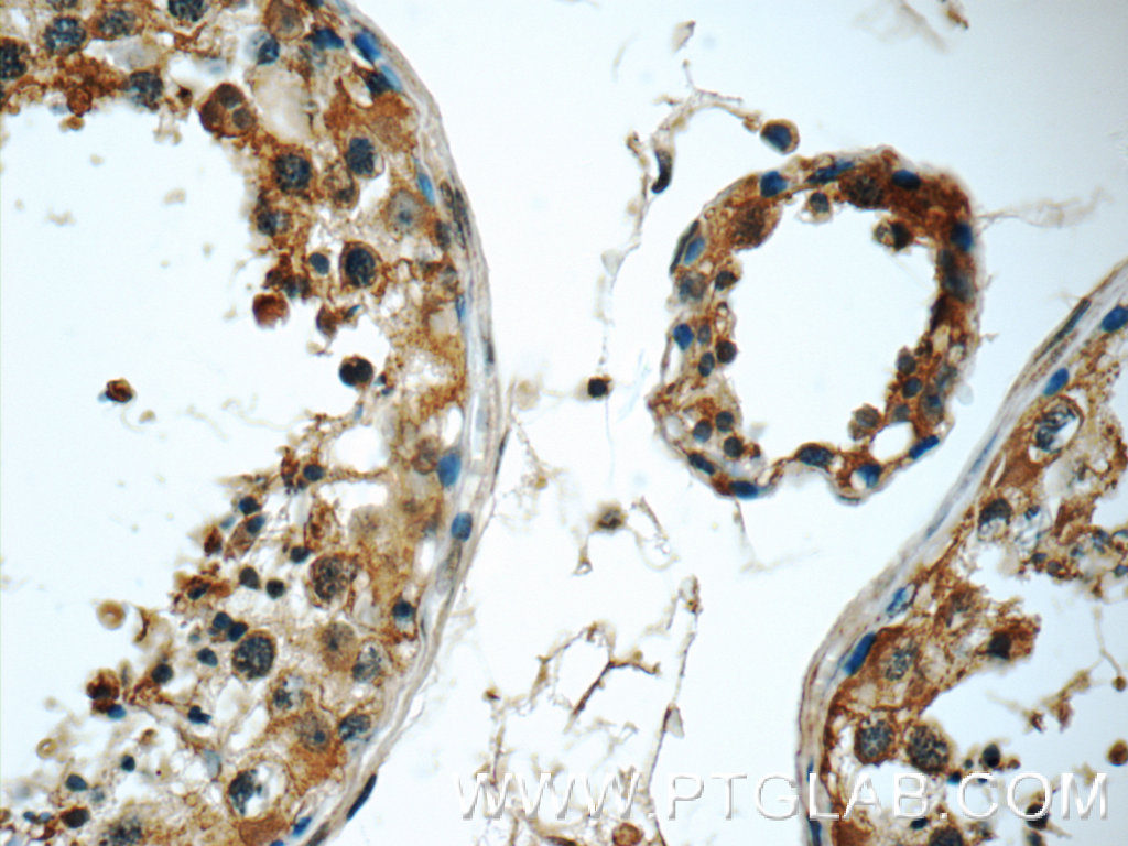 IHC staining of human testis using 17730-1-AP