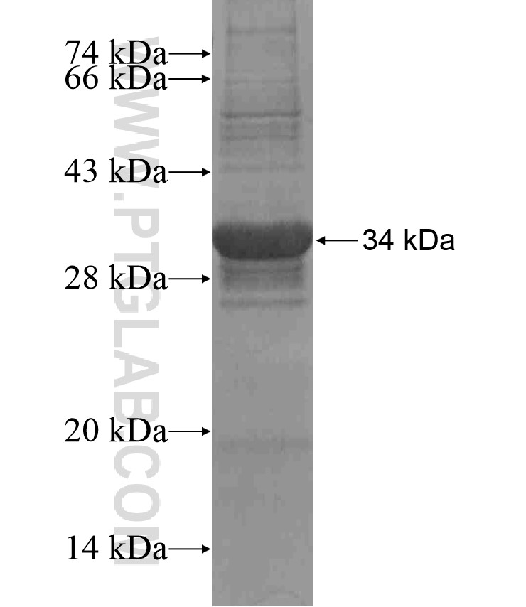 TSPAN11 fusion protein Ag17137 SDS-PAGE TSPAN11 fusion protein Ag17137 SDS-PAGE