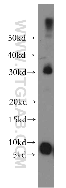 WB analysis of mouse lung using 13570-1-AP