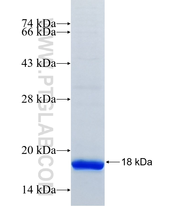 TSPAN14 fusion protein Ag7660 SDS-PAGE