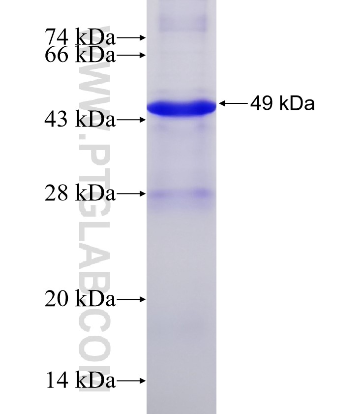 TSPAN15 fusion protein Ag0710 SDS-PAGE