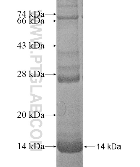 TSPAN16 fusion protein Ag20377 SDS-PAGE TSPAN16 fusion protein Ag20377 SDS-PAGE