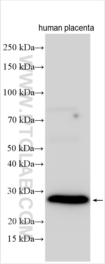 WB analysis using 15919-1-AP