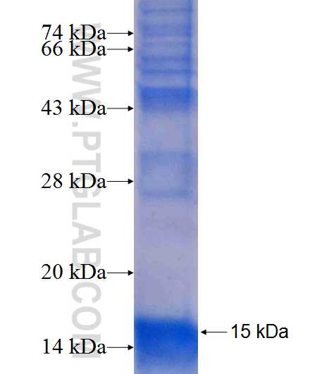TSPAN18 fusion protein Ag9162 SDS-PAGE TSPAN18 fusion protein Ag9162 SDS-PAGE