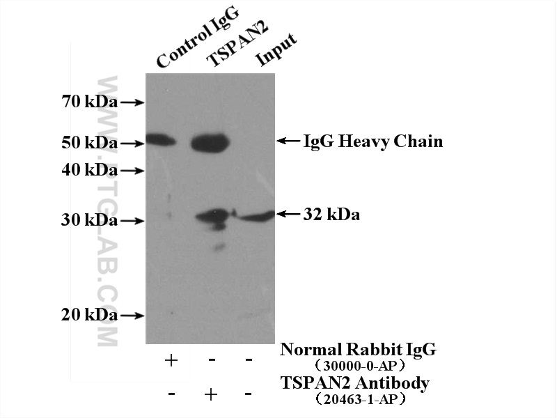 IP experiment of HL-60 using 20463-1-AP