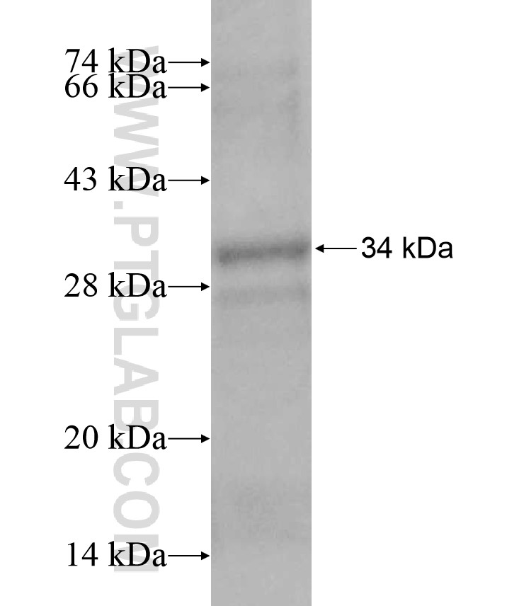 TSPAN31 fusion protein Ag17138 SDS-PAGE