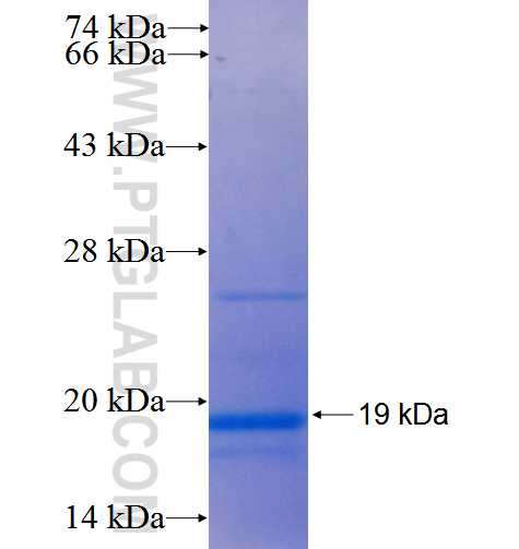 TSPAN33 fusion protein Ag5935 SDS-PAGE TSPAN33 fusion protein Ag5935 SDS-PAGE