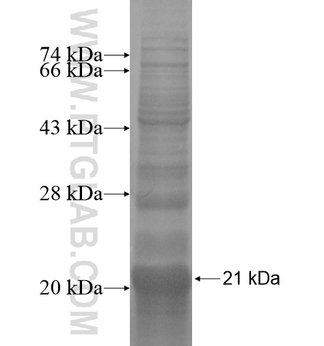 TSPAN5 fusion protein Ag14485 SDS-PAGE TSPAN5 fusion protein Ag14485 SDS-PAGE