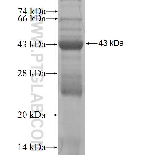 TSPAN6 fusion protein Ag2964 SDS-PAGE