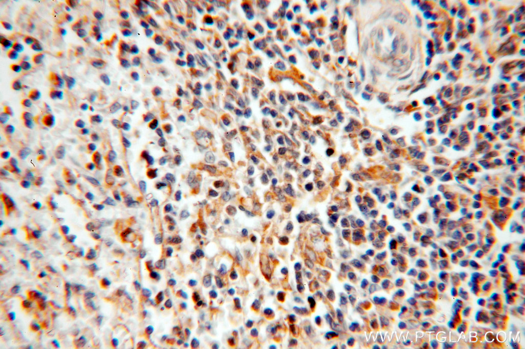 IHC staining of human spleen using 18695-1-AP