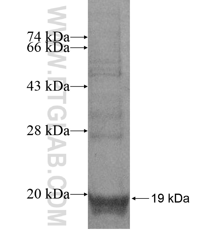 TSPAN8 fusion protein Ag16940 SDS-PAGE TSPAN8 fusion protein Ag16940 SDS-PAGE