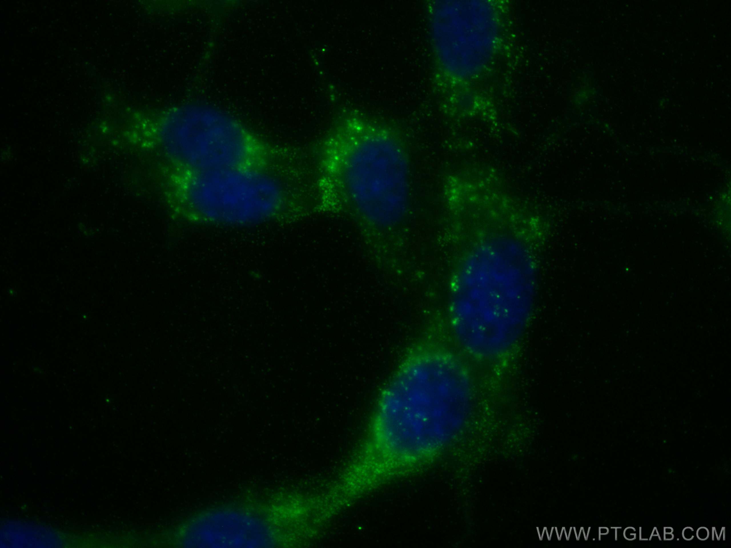 IF Staining of NIH/3T3 using 68137-1-Ig (same clone as 68137-1-PBS)