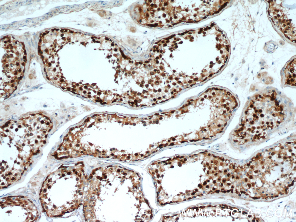 IHC staining of human testis using 22257-1-AP