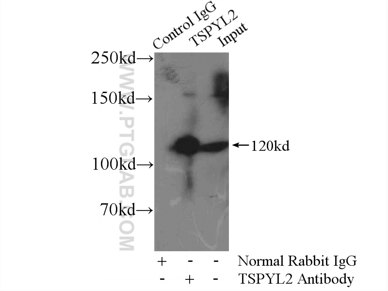 IP experiment of HEK-293 using 12087-2-AP