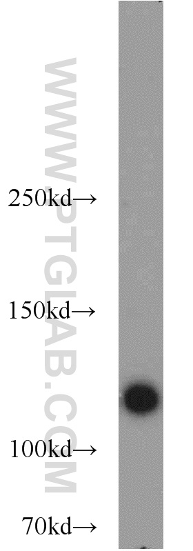 WB analysis of HeLa using 12087-2-AP