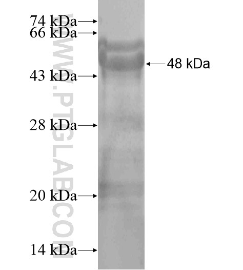 TSPYL3 fusion protein Ag19312 SDS-PAGE TSPYL3 fusion protein Ag19312 SDS-PAGE