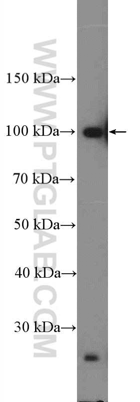 WB analysis of L02 using 16887-1-AP