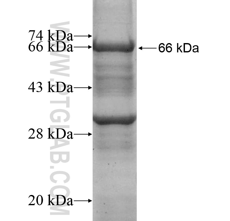 TSR1 fusion protein Ag10394 SDS-PAGE