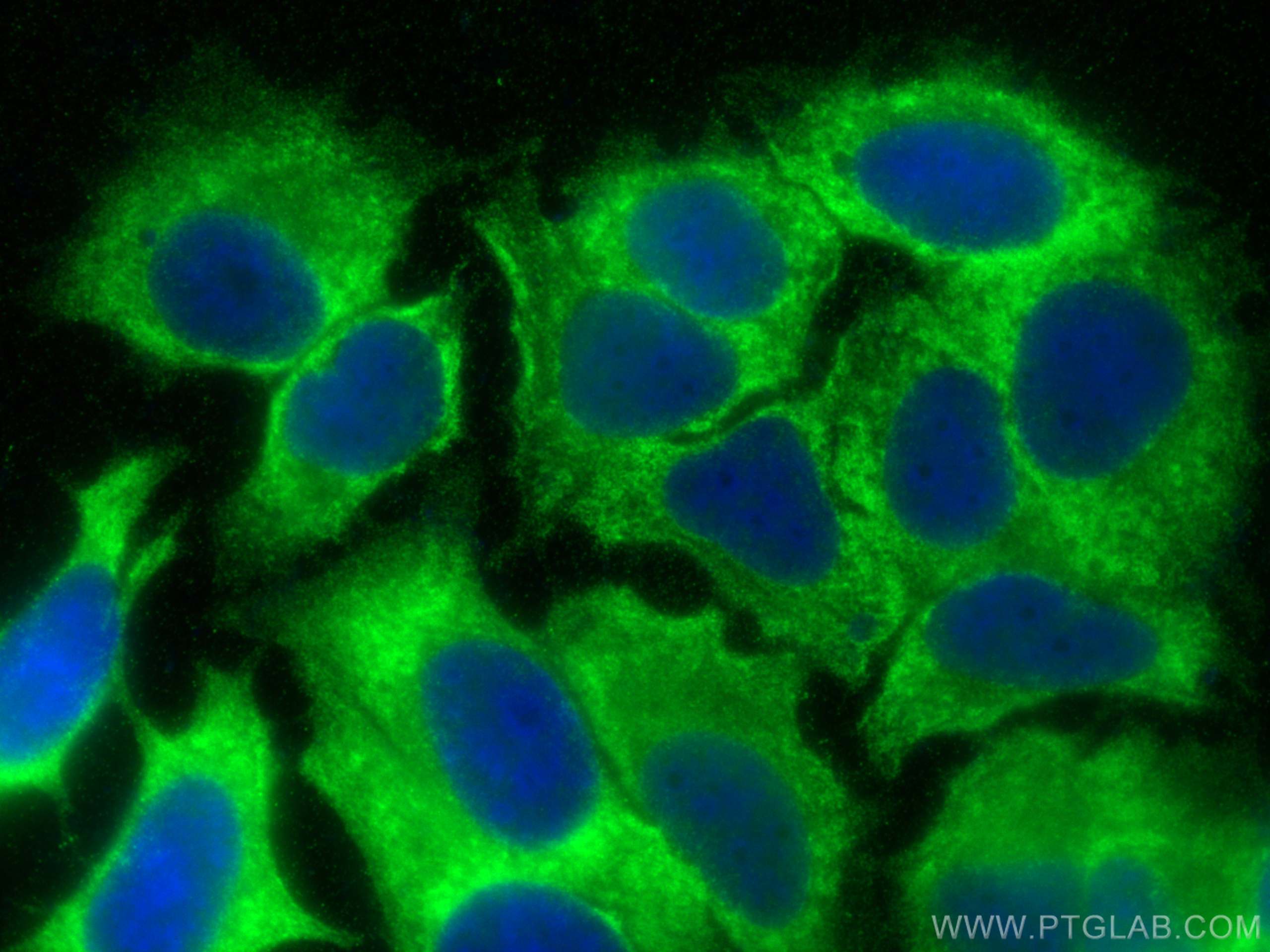 IF Staining of MCF-7 using 16263-1-AP (same clone as 16263-1-PBS)