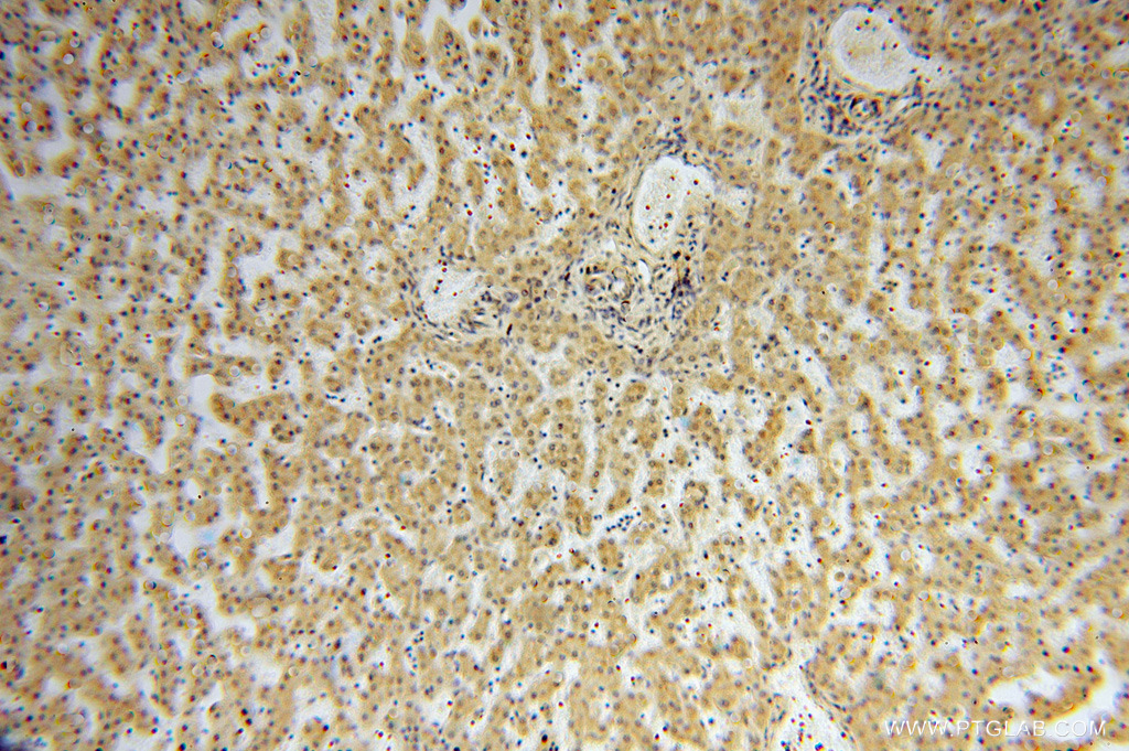 IHC staining of human liver using 16263-1-AP (same clone as 16263-1-PBS)