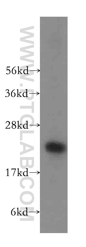 WB analysis of HeLa using 16263-1-AP (same clone as 16263-1-PBS)