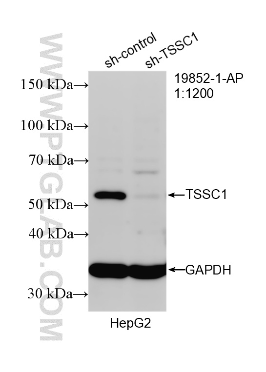WB analysis of HepG2 using 19852-1-AP WB analysis of HepG2 using 19852-1-AP