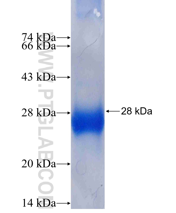 TSSK2 fusion protein Ag5162 SDS-PAGE