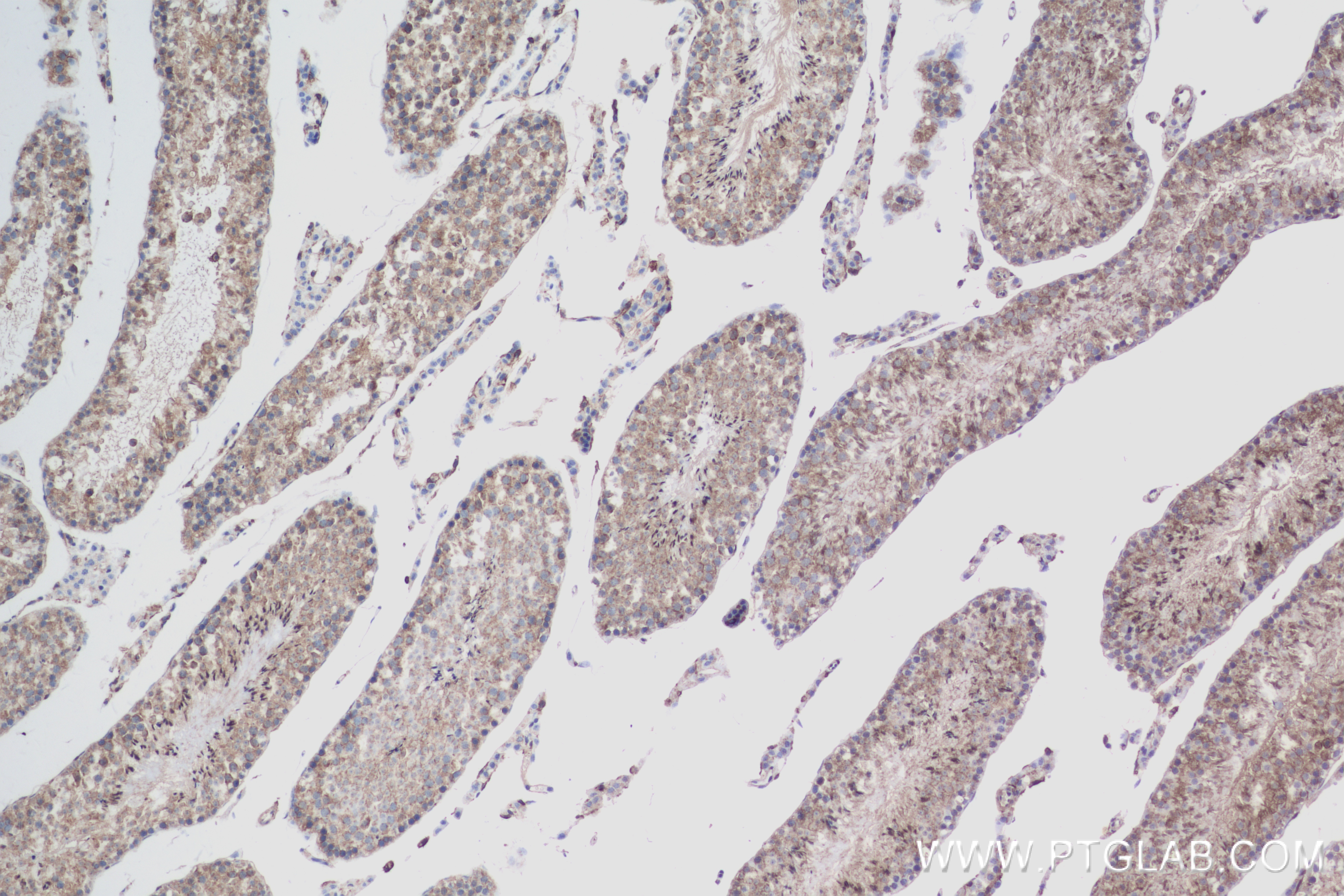 IHC staining of mouse testis using 83401-4-RR (same clone as 83401-4-PBS)