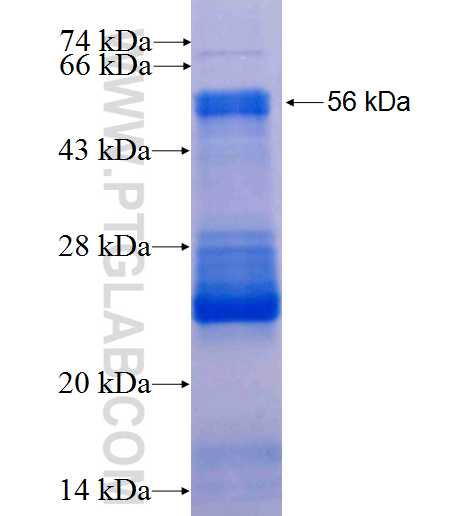 TSSK6 fusion protein Ag5209 SDS-PAGE