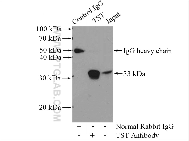 IP experiment of HEK-293 using 16311-1-AP