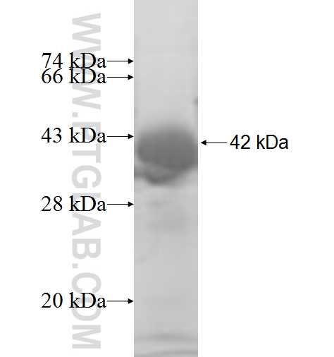 TSTA3 fusion protein Ag7473 SDS-PAGE TSTA3 fusion protein Ag7473 SDS-PAGE
