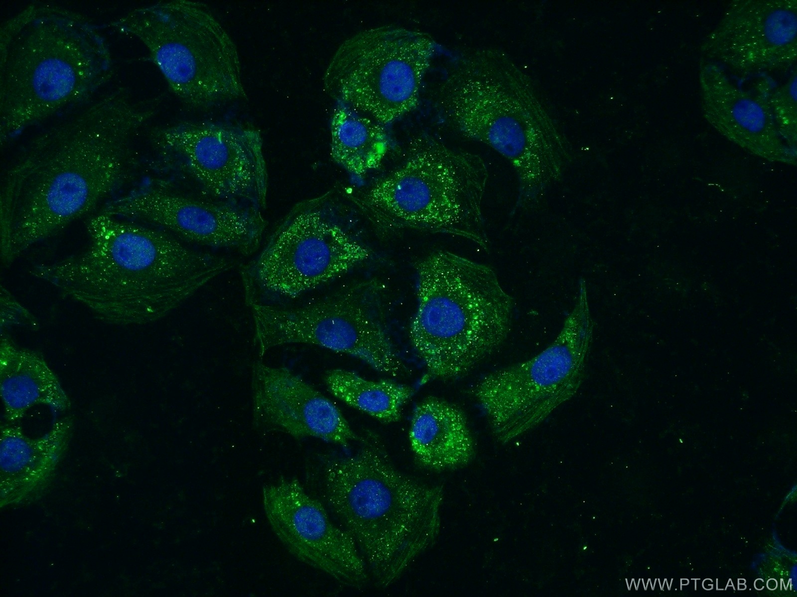 IF Staining of SH-SY5Y using 15072-1-AP