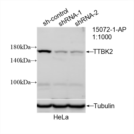 WB analysis of HeLa using 15072-1-AP