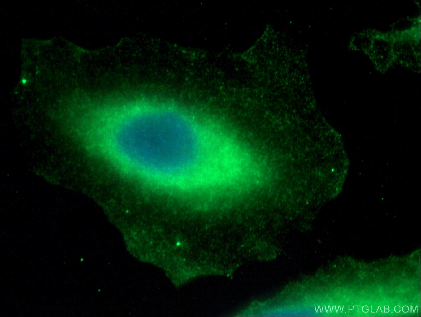 IF Staining of A549 using 28216-1-AP