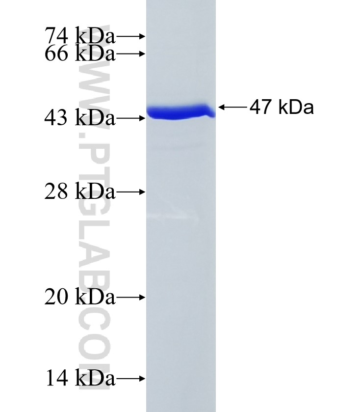 TTC18 fusion protein Ag35209 SDS-PAGE