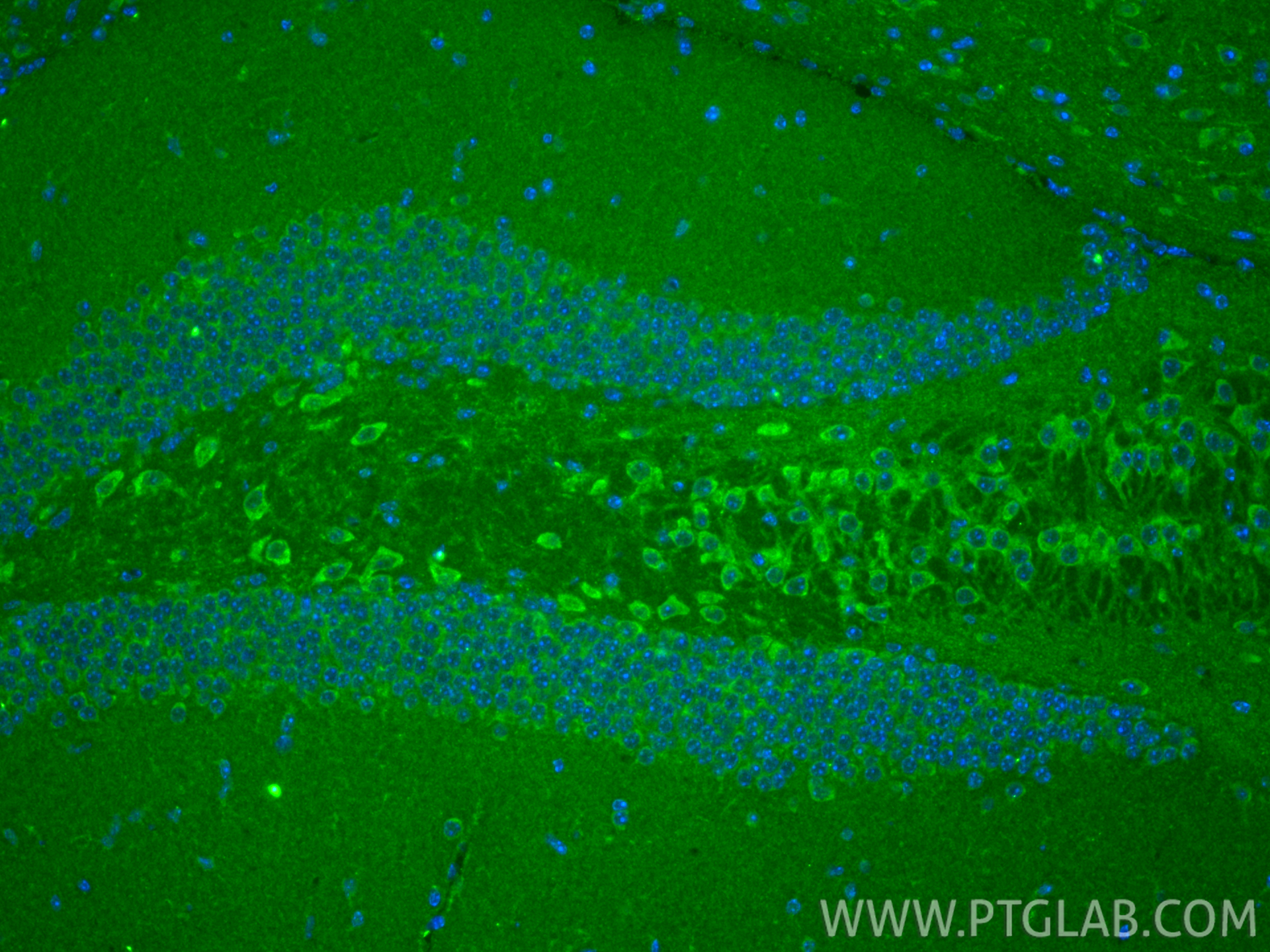 IF Staining of mouse brain using 20875-1-AP IF Staining of mouse brain using 20875-1-AP