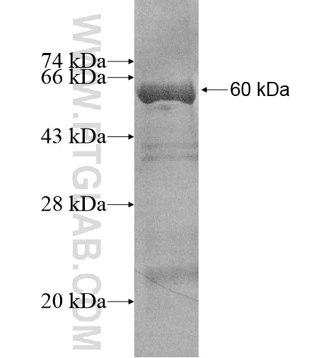 TTC19 fusion protein Ag14974 SDS-PAGE