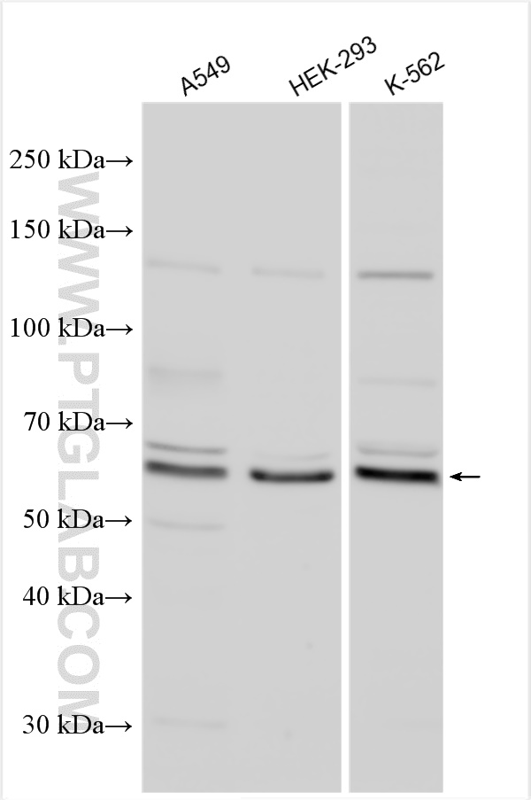 Various lysates were subjected to SDS PAGE followed by western blot with 30112-1-AP (TTC21B antibody) at dilution of 1:5000 incubated at room temperature for 1.5 hours. WB analysis using 30112-1-AP