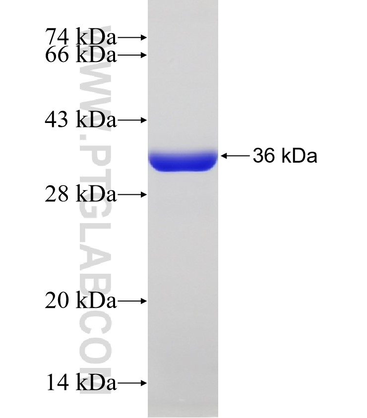 TTC21B fusion protein Ag32456 SDS-PAGE TTC21B fusion protein Ag32456 SDS-PAGE