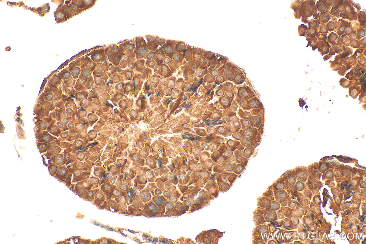 IHC staining of mouse testis using 25083-1-AP