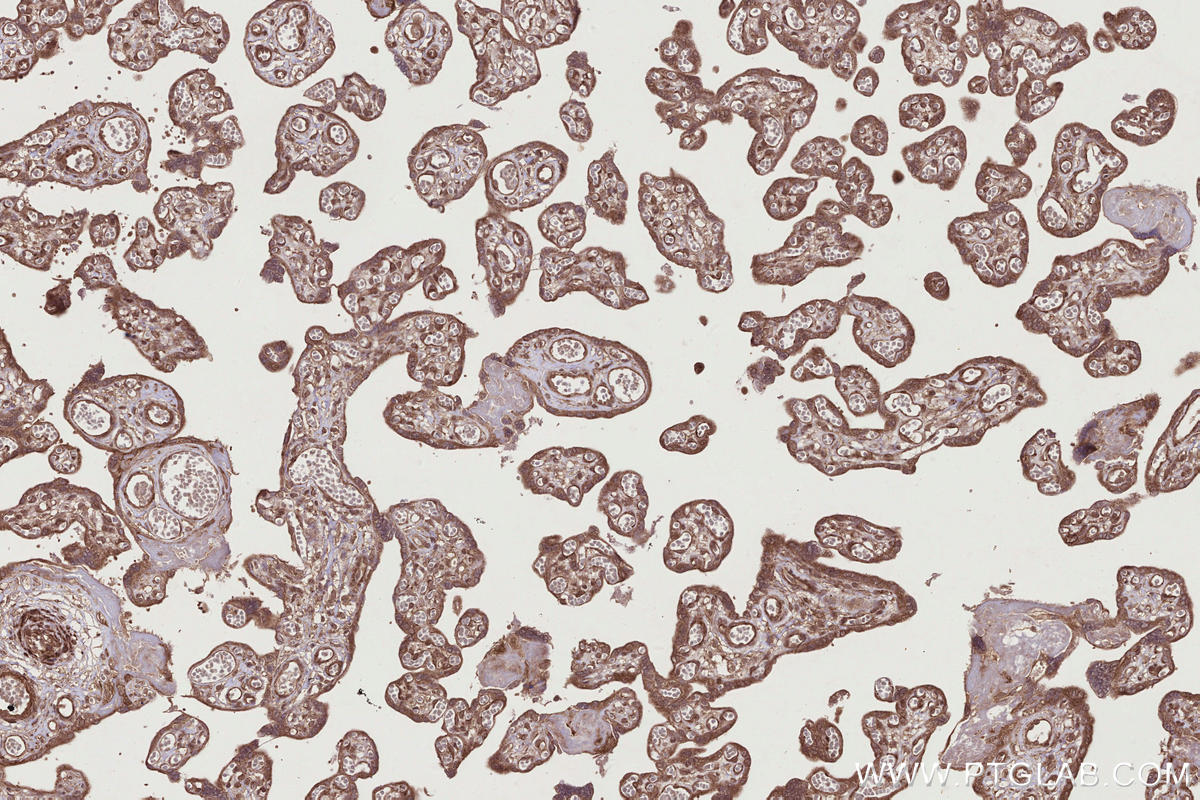 IHC staining of human placenta using 25701-1-AP