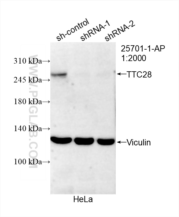WB analysis of HeLa using 25701-1-AP