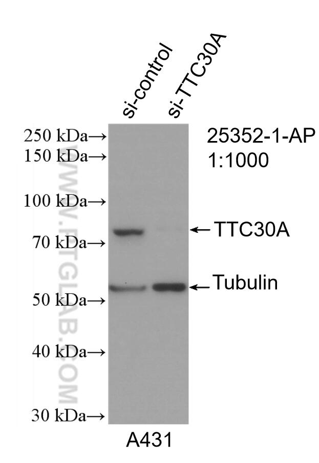 WB analysis of A431 using 25352-1-AP