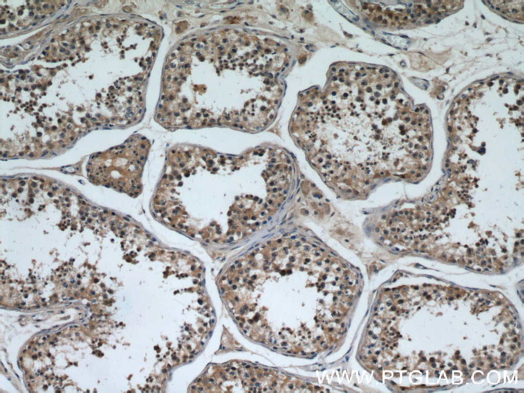 IHC staining of human testis using 21693-1-AP