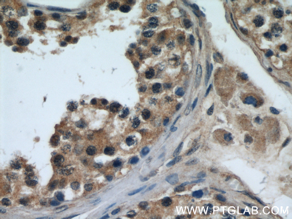 IHC staining of human testis using 21693-1-AP