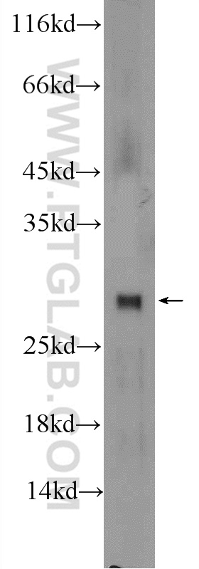mouse testis tissue were subjected to SDS PAGE followed by western blot with 25422-1-AP (TTC32 Antibody) at dilution of 1:300  incubated at room temperature for 1.5 hours. WB analysis of mouse testis using 25422-1-AP